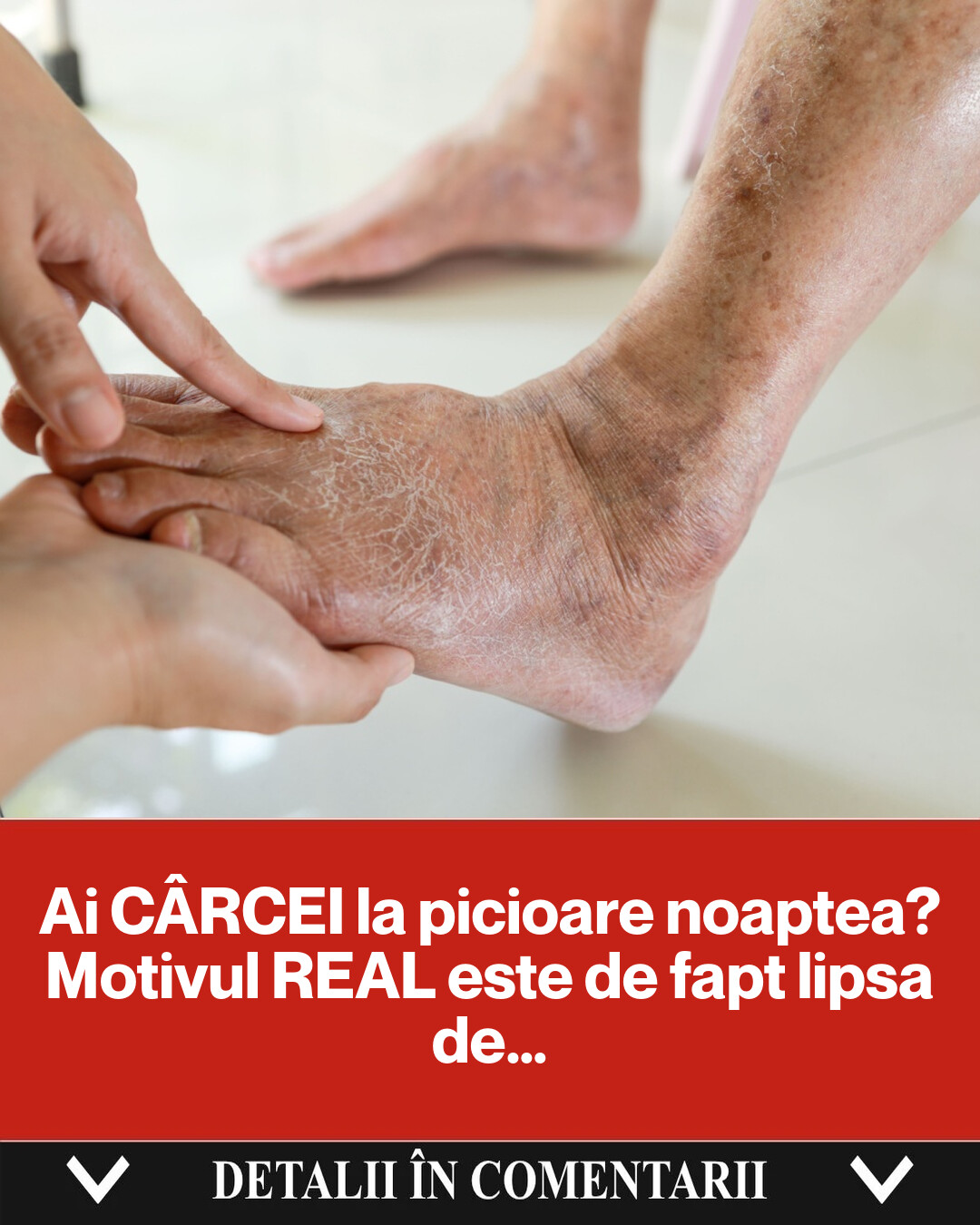 De ce apar cârceii la picioare noaptea și cum îi putem preveni